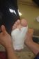 Aprendiendo la Aplicacion de Diferentes Vendajes (Fascitis Plantar)